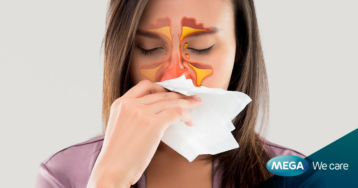 Cómo prevenir y aliviar la congestión nasal